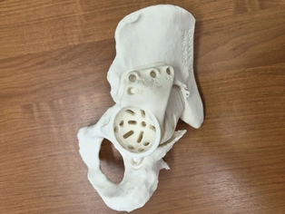 Точность до миллиметра: как 3D-печать меняет судьбы пациентов с дефектами костей